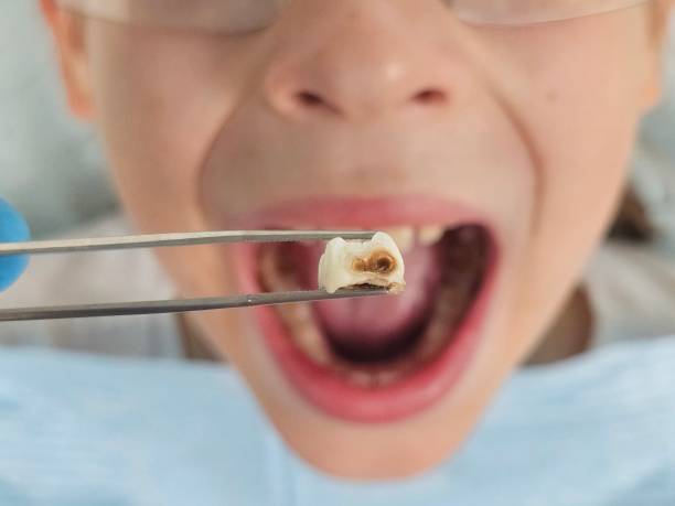 Best Teeth Whitening  in New Castle, PA