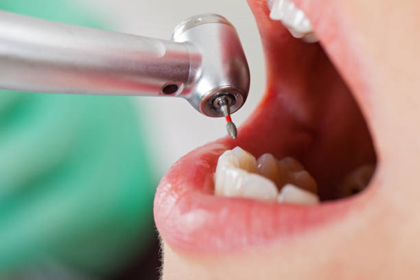 Best Emergency Tooth Extraction  in New Castle, PA